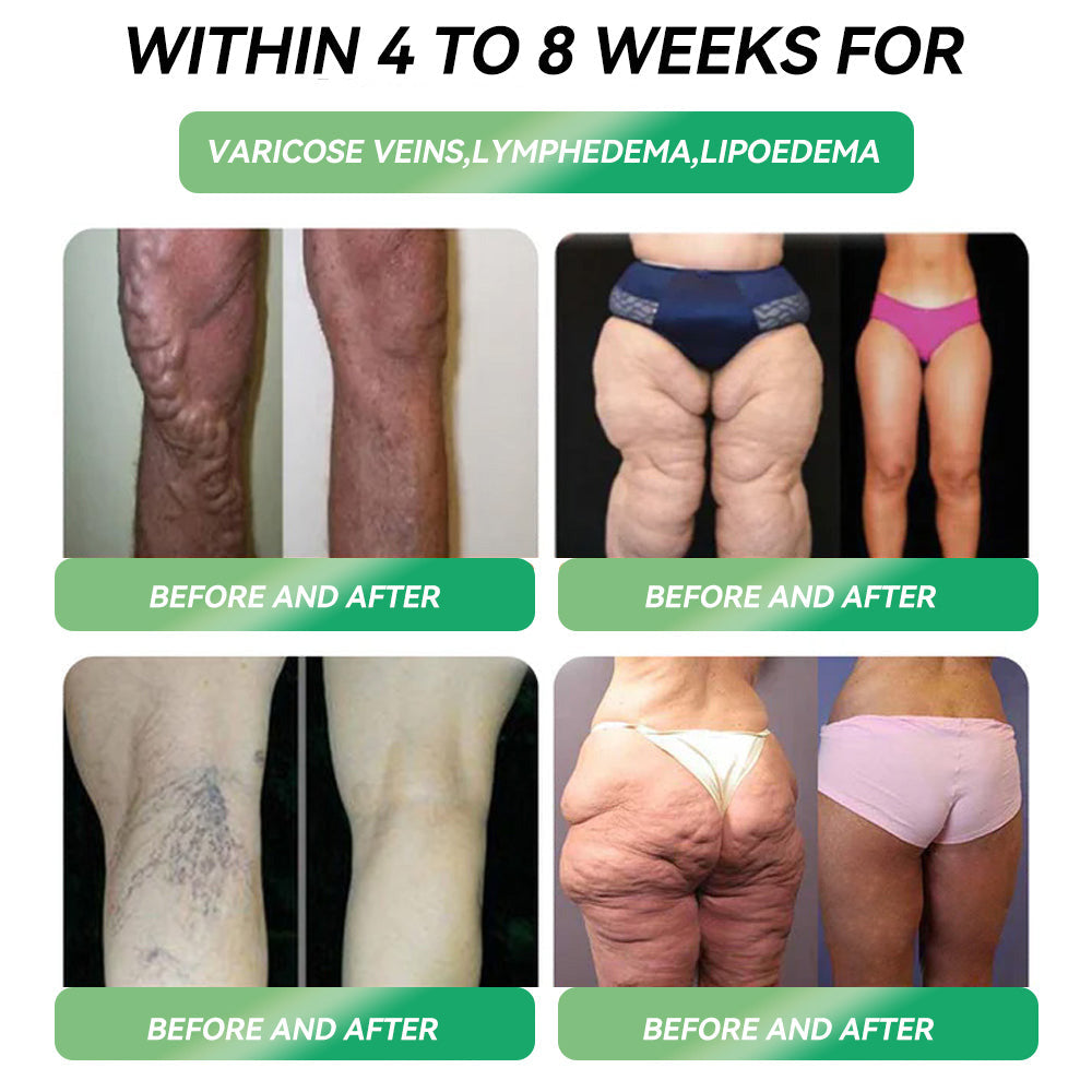 🔥 Only 10 boxes left! We're giving you an extra 30% OFF! HHVB® GLP-1 Micro Slimming Beads are doctor-tested and proven effective — just 7 to 8 boxes are enough to help manage your weight and blood sugar levels with long-lasting results.